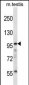 SFRS14 Antibody (C-term)
